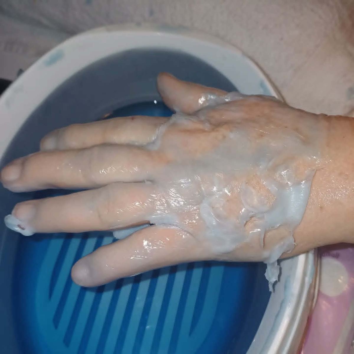 Paraffin vax på handen